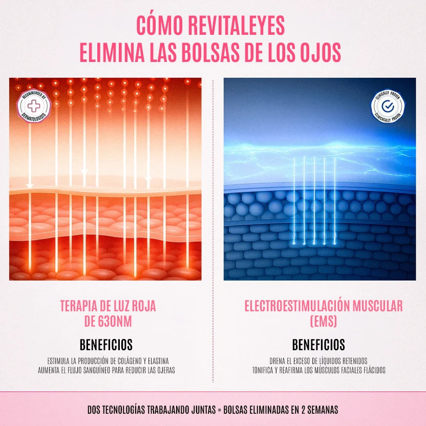 RevitalEyes® 2 en 1: Terapia de Luz Roja y EMS para Eliminar Bolsas de los Ojos